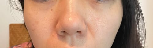 Customer photo review of Dr. Pen M8