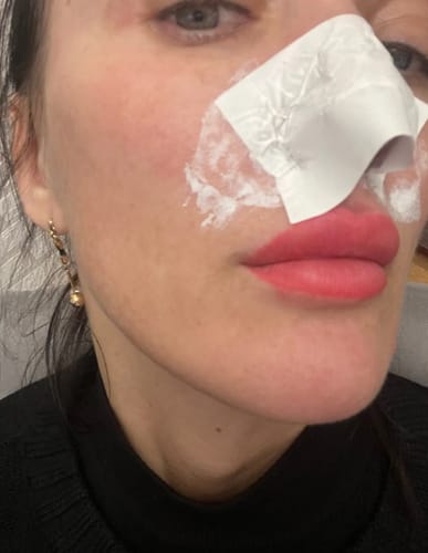 Customer photo review of Luelle Pore Strips