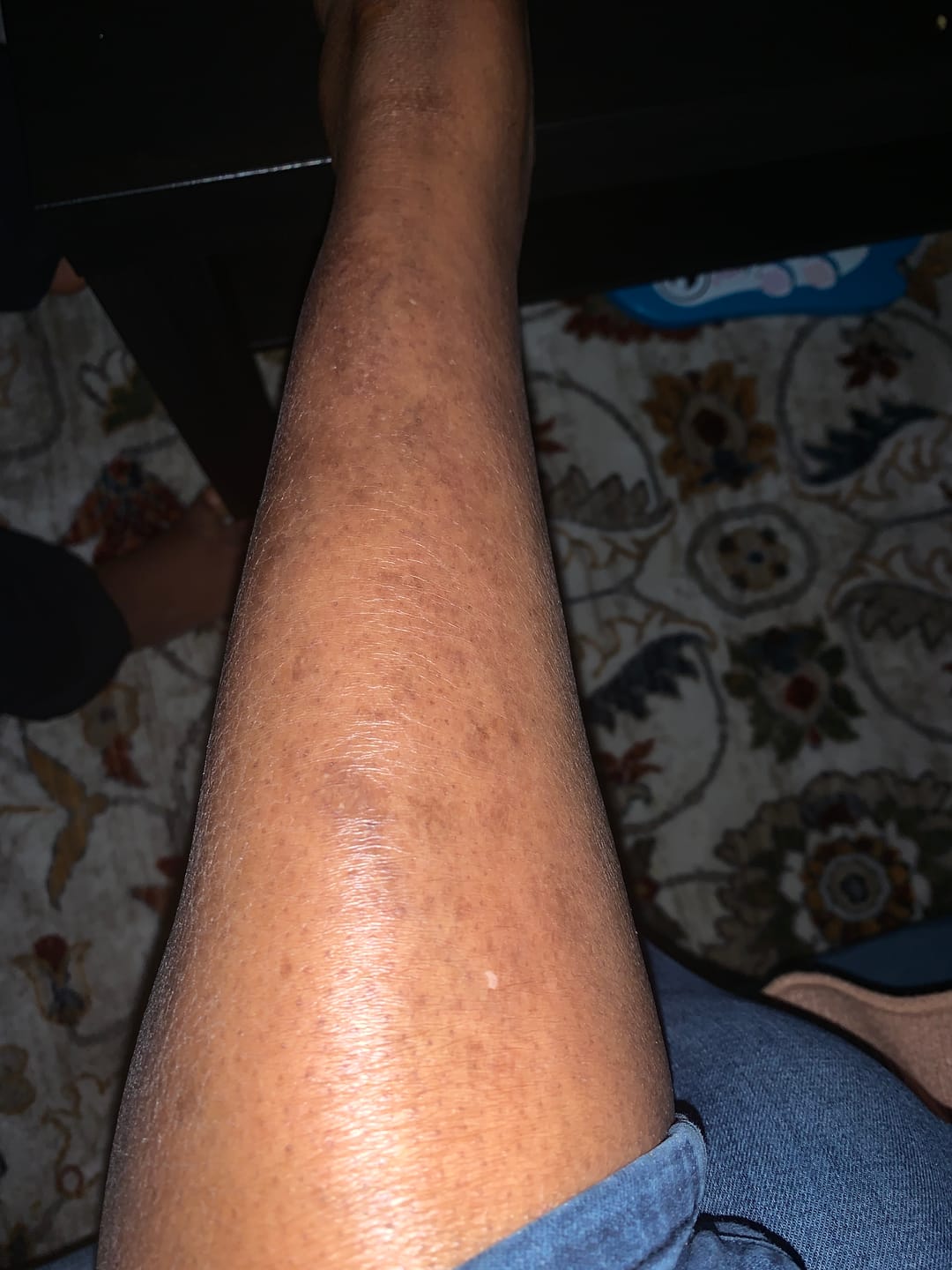 Customer photo review of Magix Cream