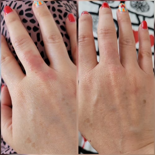 Customer photo review of Emulsión Recuperadora