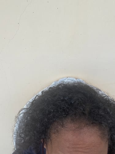 Customer photo review of Gummies Croissance et Volume