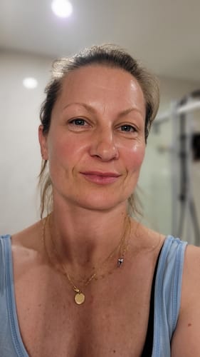 Customer photo review of LOVESKIN Dry/ Mature Skincare Ritual