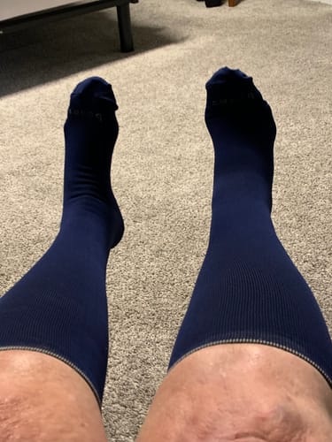 Customer photo review of Closed Toe: 15-20 mmHg - SOLID