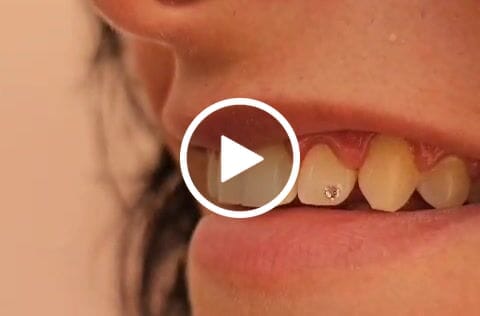 Customer video review of Crystal Clear 1.8mm - 6-pack