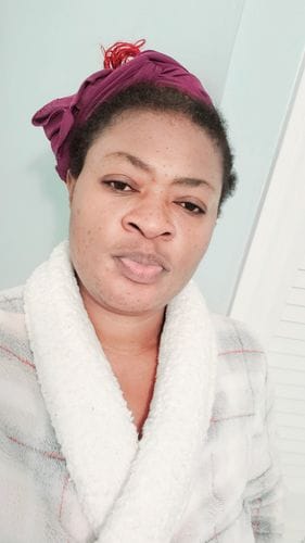 Customer photo review of Fair and White Original Brightening Serum 30 ml / 1 fl oz