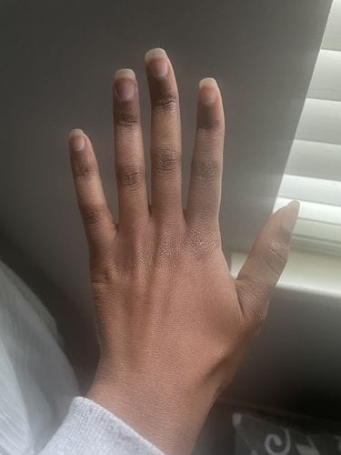 Customer photo review of Fair and White Glutathion Extra Serum Anti-Dark Spot 30ml / 1.01 Fl Oz