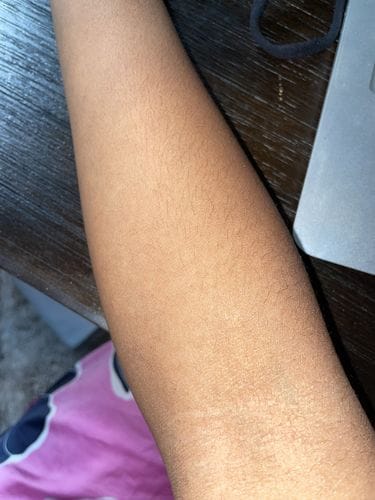 Customer photo review of Fair and White Original Glutathion Extra Brightening Lotion 500ml / 16.90 fl oz