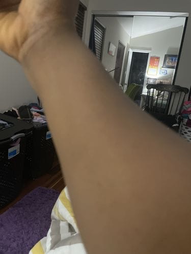 Customer photo review of Fair and White Glutathion Extra Serum Anti-Dark Spot 30ml / 1.01 Fl Oz