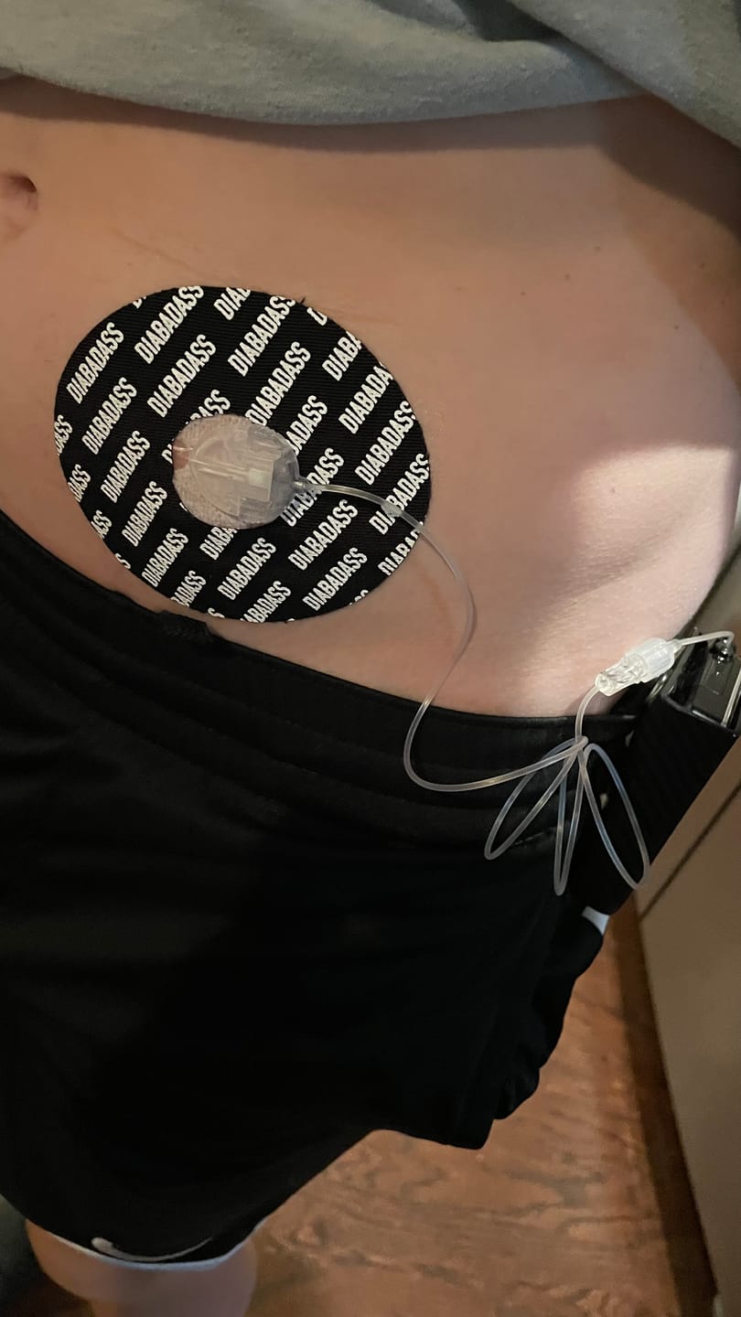 Customer photo review of Skin Grip Original - Medtronic Guardian/Enlite Adhesive Patches