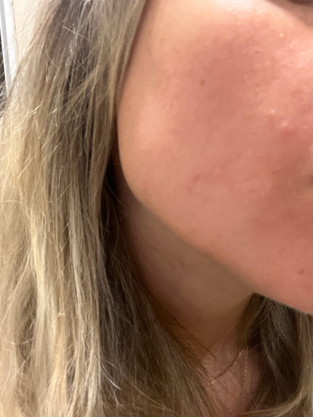 Customer photo review of Mitrinošs un aizsargājošs losjons ar C vitamīnu un bifidu Mary&May Vitamine C Bifida Lotion