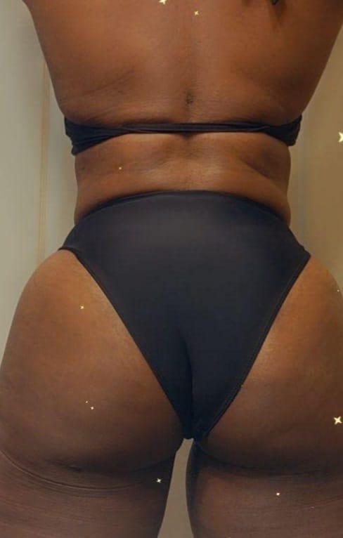 Customer photo review of Butt & Breast enlargement with Maca root, Fenugreek, and other natural ingredients - Natural Curves Capsules made from natural ingredients