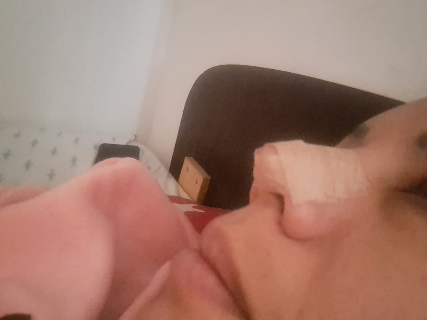 Customer photo review of Micropore Piel 1.25 cm x 9.1 cm