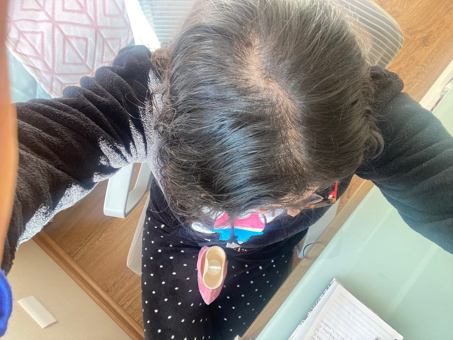 Customer photo review of Tónico Anticaída