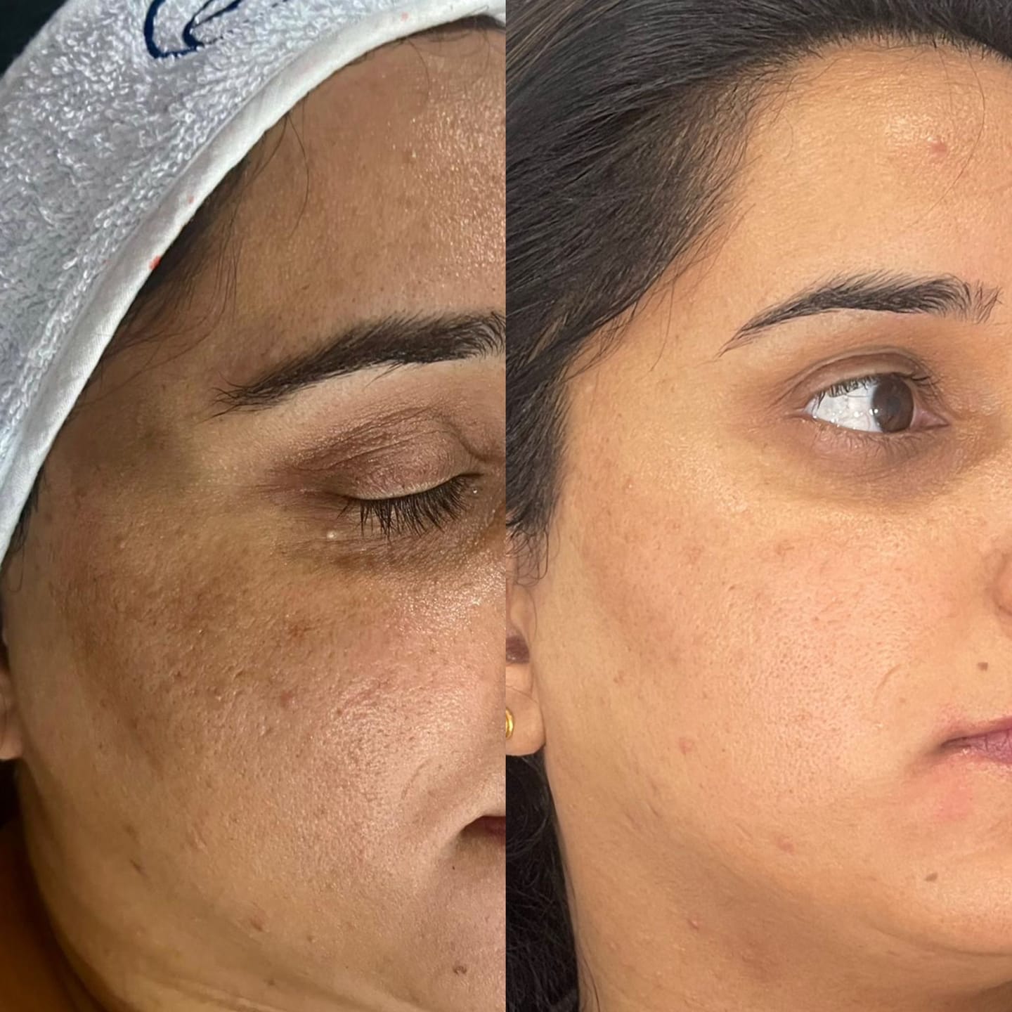 Customer photo review of Zena 100% Organic Algae Peel