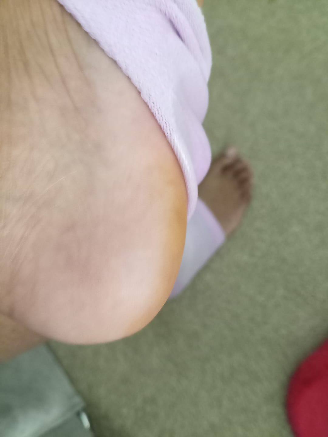 Customer photo review of XL Glass Foot File and Heel Sock Bundle