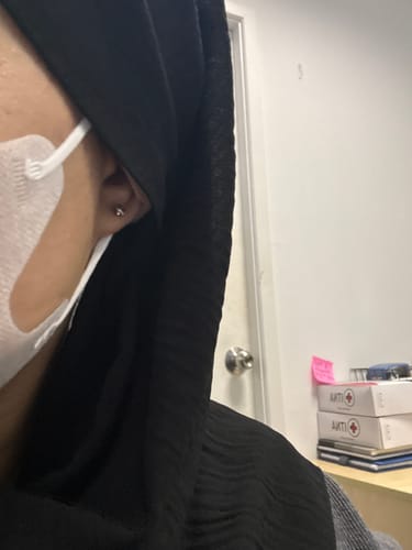 Customer photo review of After Piercing Care Gel