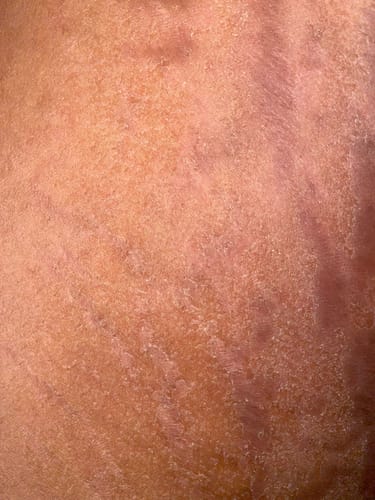 Customer photo review of Peeling savon noir anti vergetures