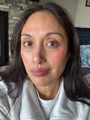 Customer photo review of Cheek Stain