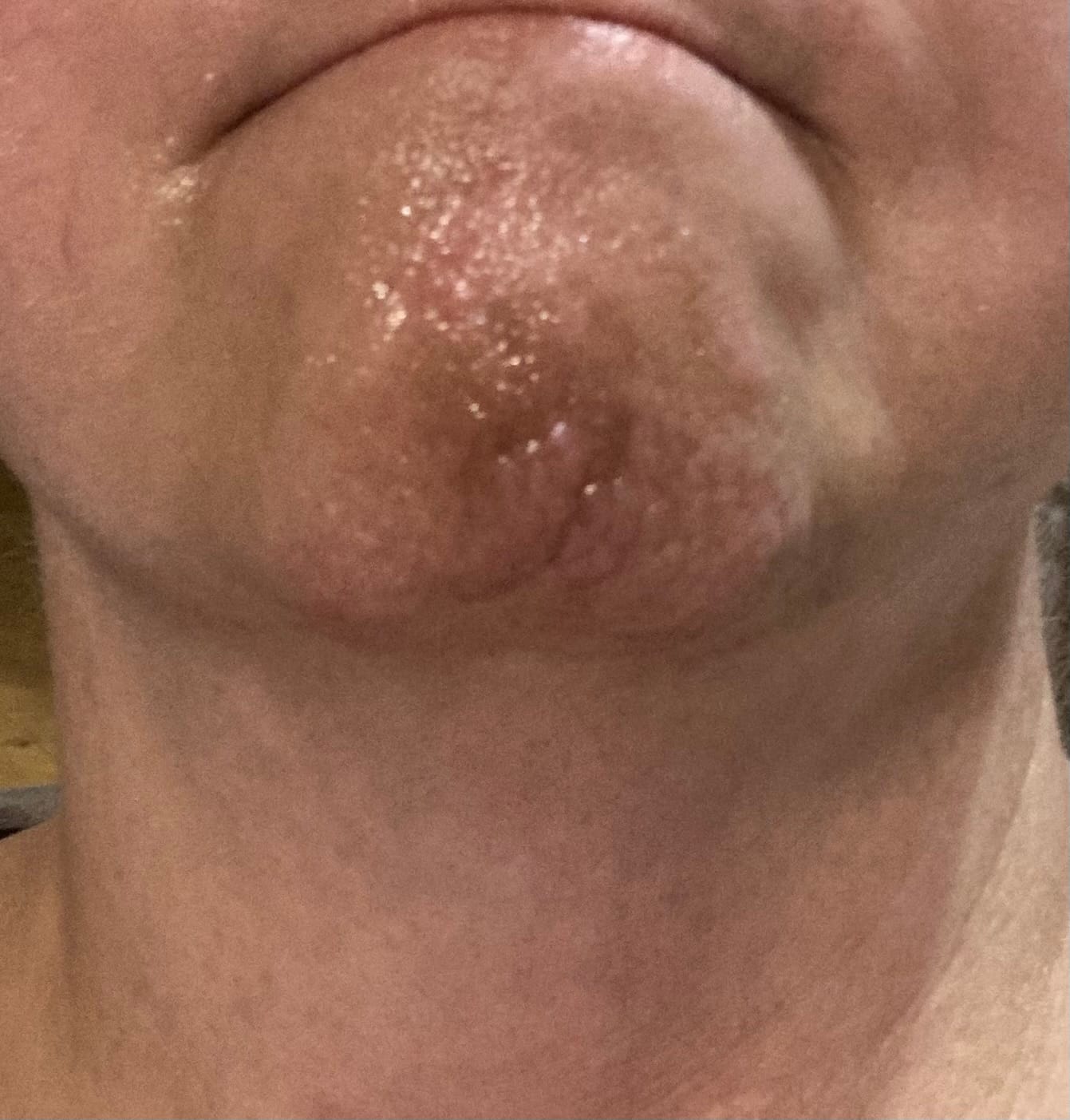 Customer photo review of FREE Healing Salve