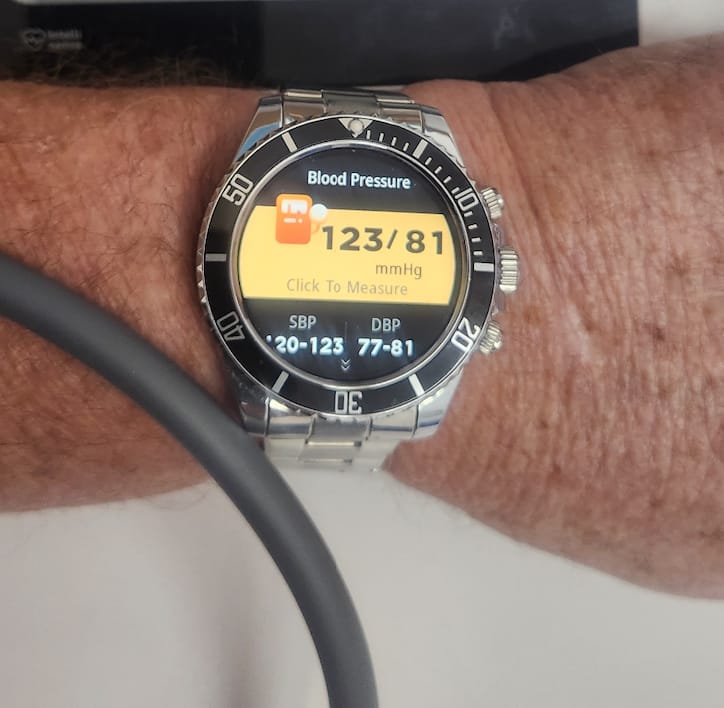 Customer photo review of Nexus Pro Smartwatch