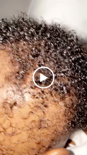 Customer video review of Happy Scalp Cream™