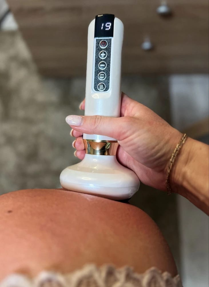 Customer photo review of Revimus Anti-Cellulite Massager