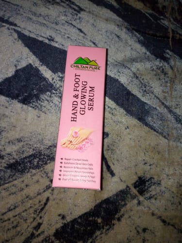 Customer photo review of Hand & Foot Glowing SERUM 🦶✋ Formulated With Multi-Vitamins & Glowing Agents, Moisturizes, Soothes & Improves Skin Texture, Makes Skin Soft & Glowing