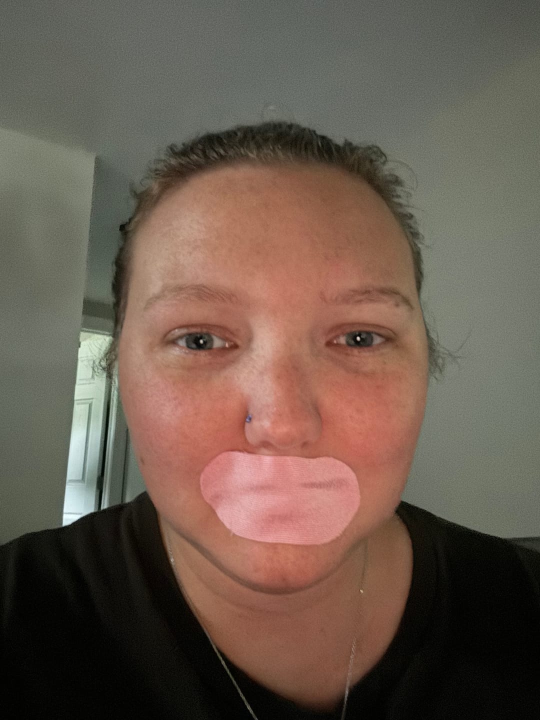Customer photo review of Hostage Mouth Tape