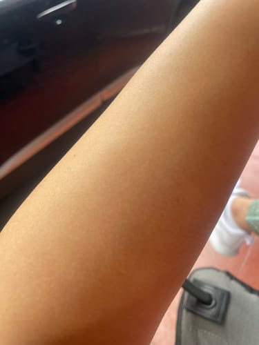 Customer photo review of Depilador Nano Pro