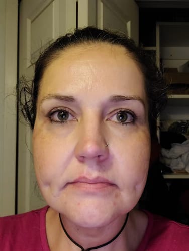 Customer photo review of Bio-Kollagen Real Deep Maske