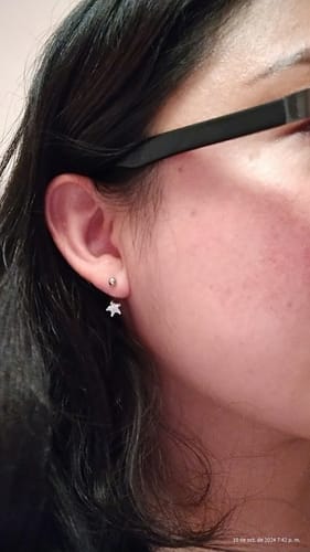 Customer photo review of Aretes Stellar