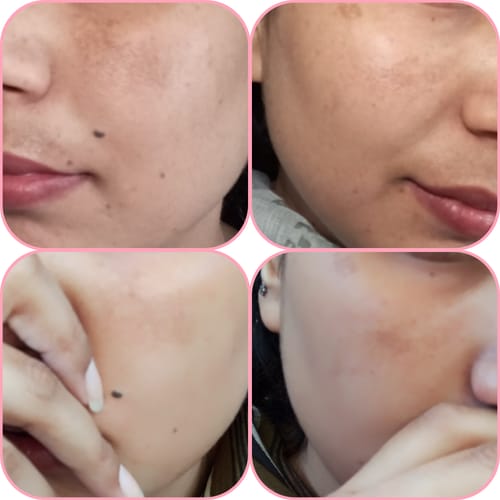 Customer photo review of Complete Fairness Radiance Bundle: Whitening Trio