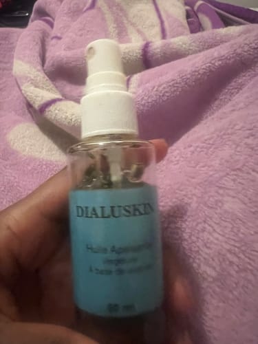 Customer photo review of Huile de vergetures apaisante à base de lavande