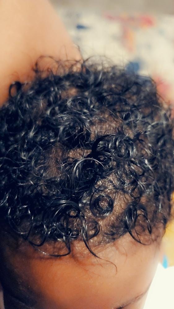 Customer photo review of Scalp Oil
