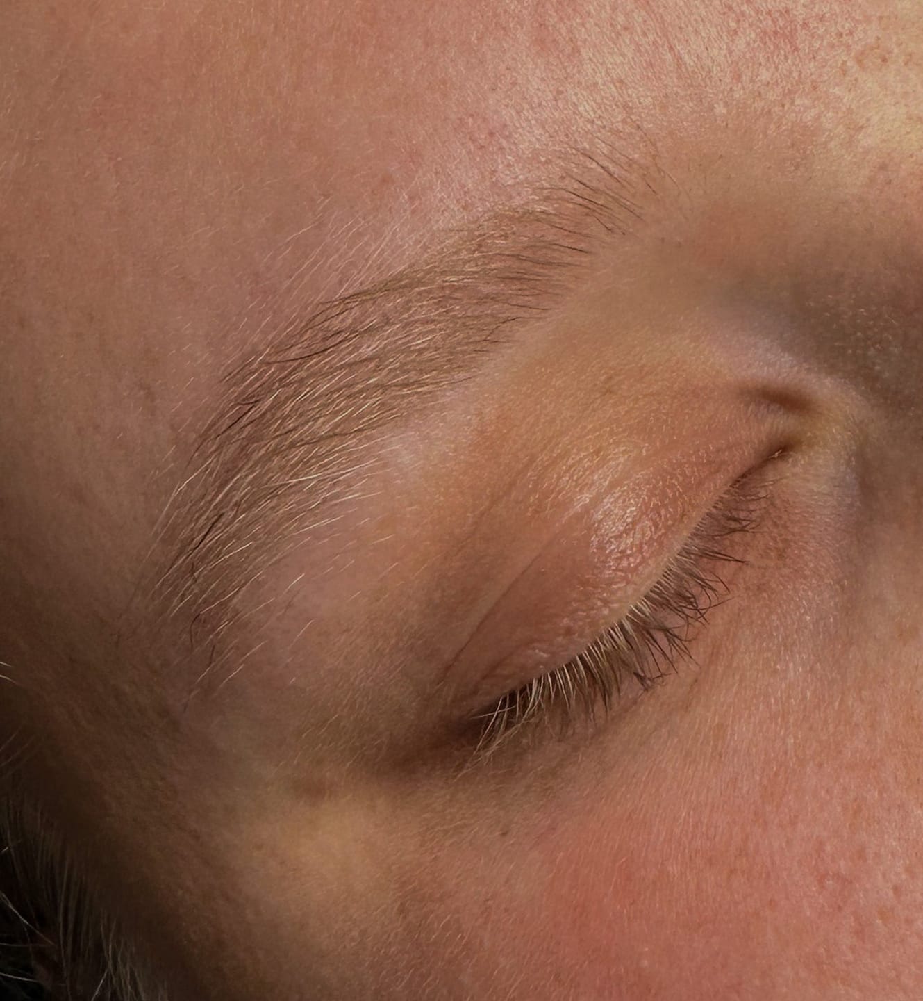 Customer photo review of DIY Brow Lifting Kit