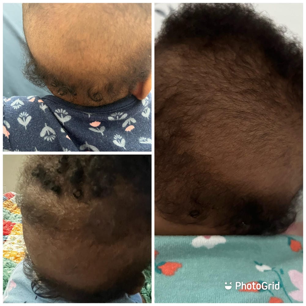 Customer photo review of Scalp Oil