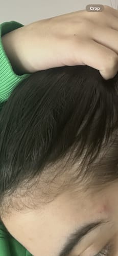 Customer photo review of The Ultimate Hair Growth Bundle