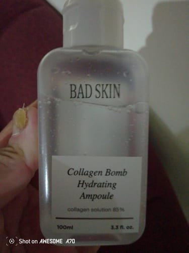 Customer photo review of Bad Skin™ Korean Collagen Bomb Hydrating Ampoule