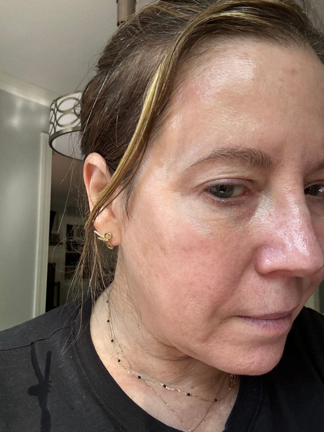 Customer photo review of Extra Strength Fading Kit
