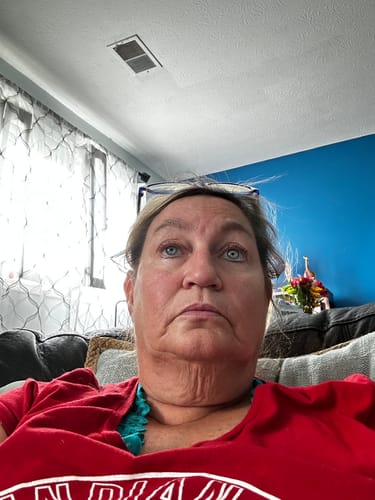 Customer photo review of Glov Micro Infusion System