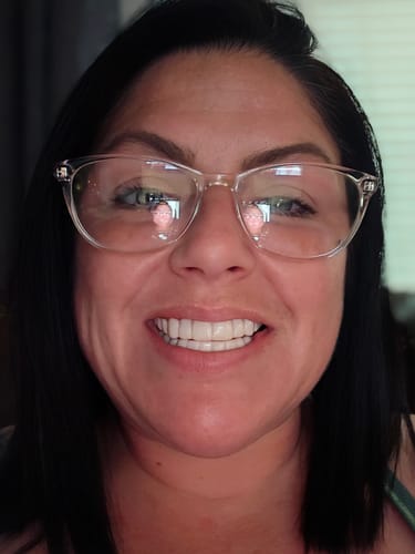 Customer photo review of Pop On Veneers with Impression Kit