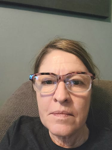 Customer photo review of Glov Anti-Aging Serum (5ml)