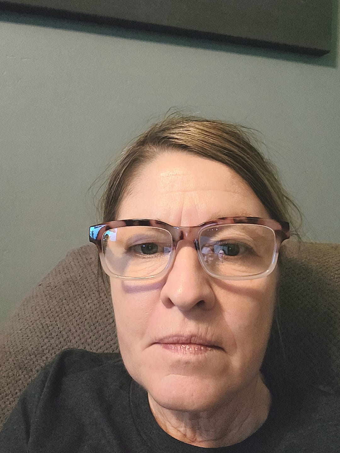 Customer photo review of Glov Anti-Aging Serum (5ml)