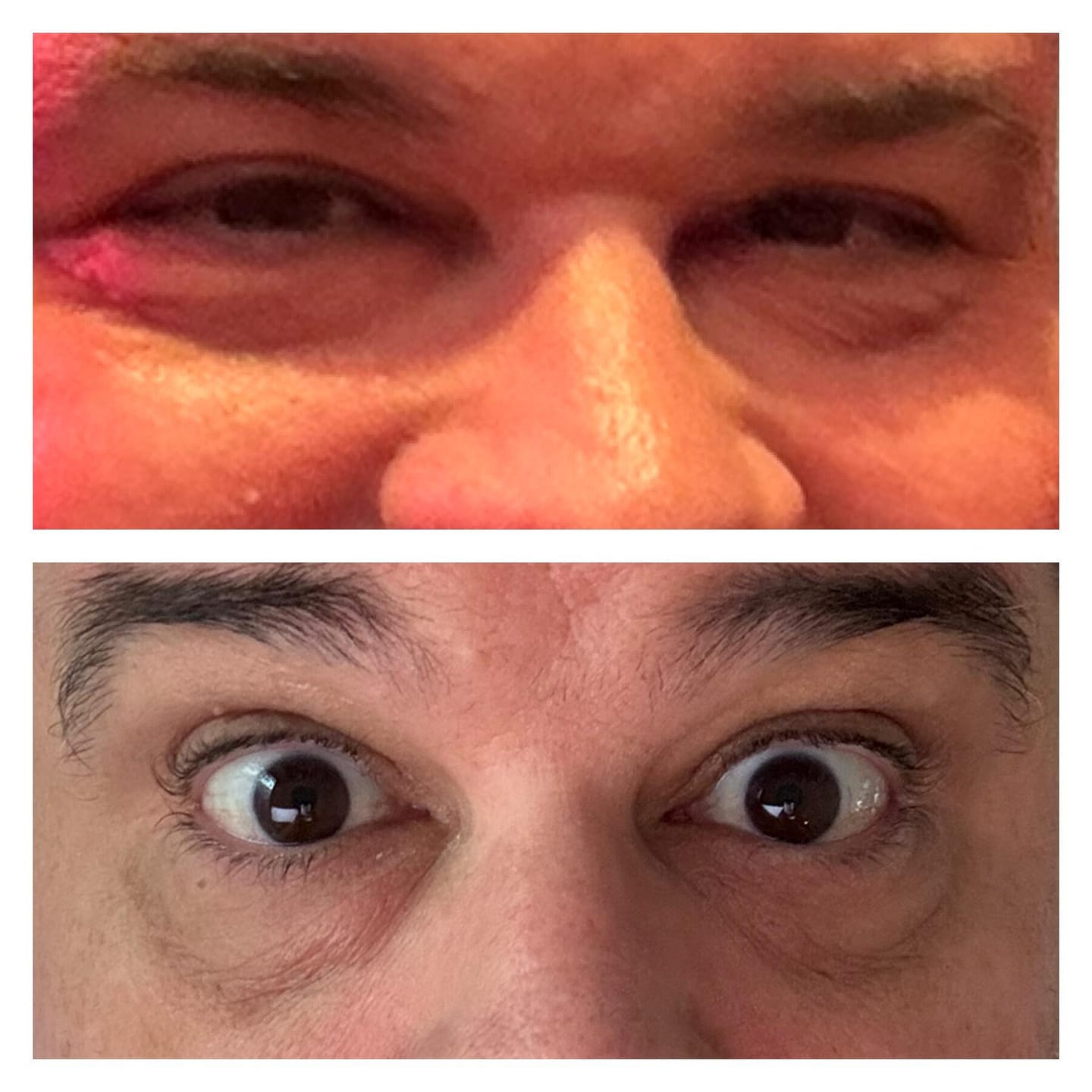 Customer photo review of Intensive Eye Cream