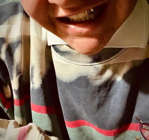 Customer photo review of PRISM (GOLD GRILLZ)