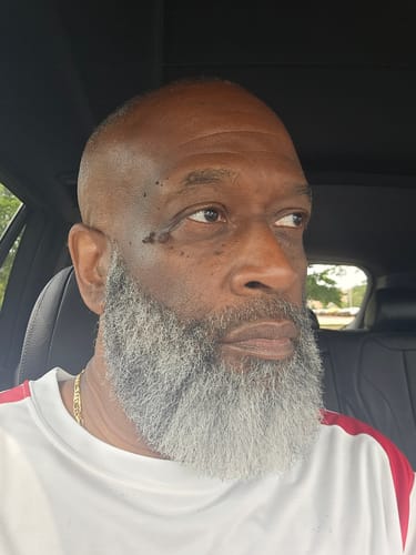 Customer photo review of Beard Care Kit