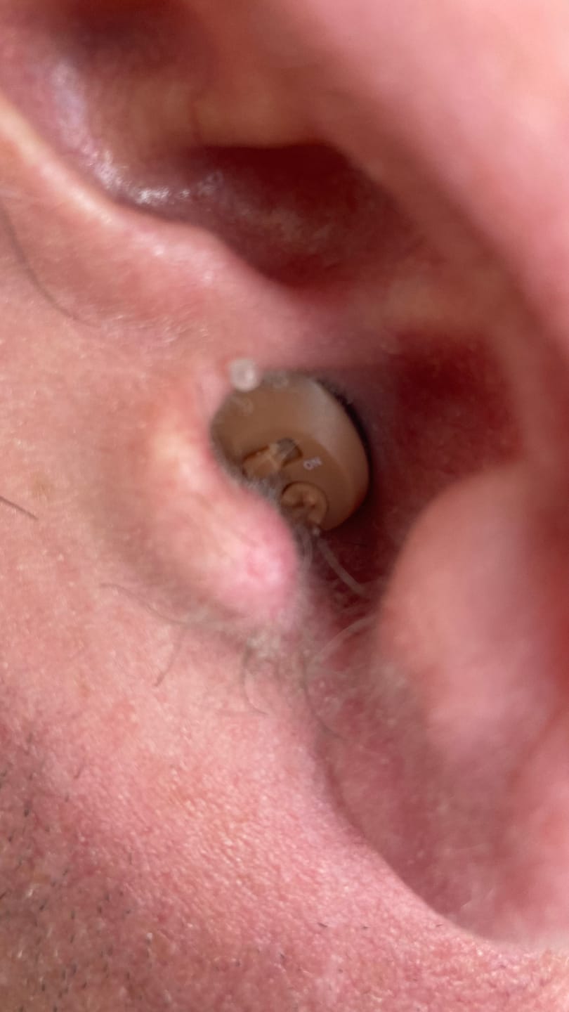 Customer photo review of Rechargeable Invisible Hearing Amplifiers | Hearing Aids with Wireless Charging Case