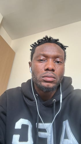 Customer photo review of Anti-Acne & Dark Spots African Soap