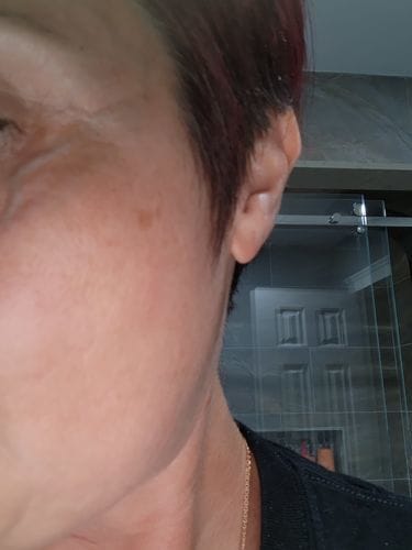 Customer photo review of Retinol Serum 30ml