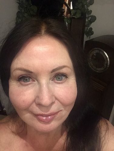 Customer photo review of Hyaluronic Acid Serum 30ml